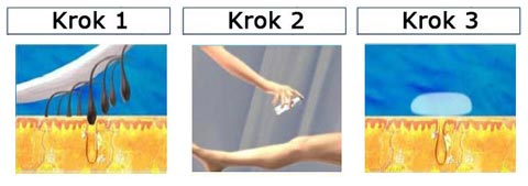 Epilfree zabieg, depilacja