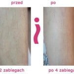 przed-i-po-nogi.jpg