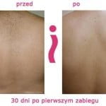 przed-i-po-plecy.jpg