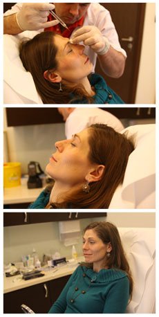 korekta nosa, Maciej Rogala, Emervel