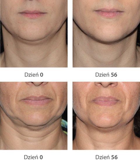 Serum Modelujące Twarz Eisenberg