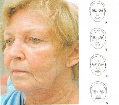starzenie się twarzy
