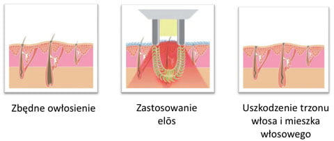 me my elos działanie