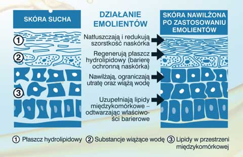 emolienty, pielęgnacja suchej skóry, kosmetyki Lirene, Lirene Emolient
