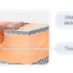 Contratubex_blizna.jpg