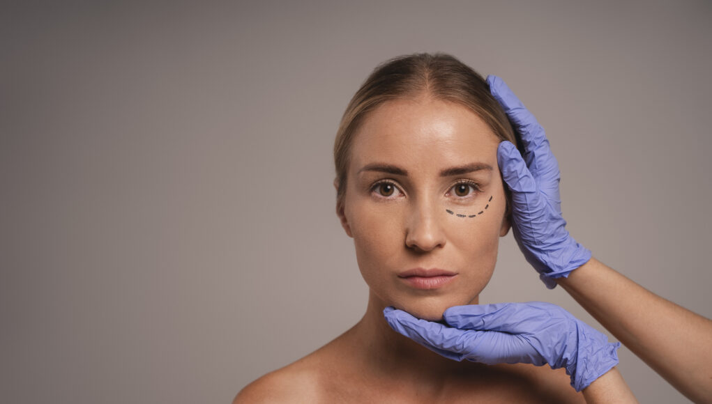 blefaroplastyka blefaroplastyka